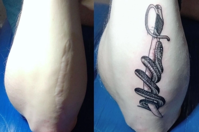 Кто-то набивает себе тату, чтобы скрыть шрамы.