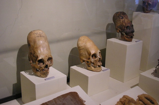 Деформированные черепа в музее Паракаса