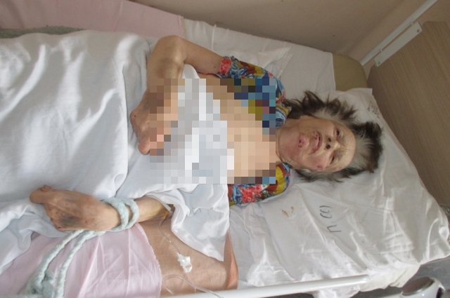 Сейчас Людмила Корытько снова в больнице. Ей сделали операцию по поводу перелома шейки бедра.