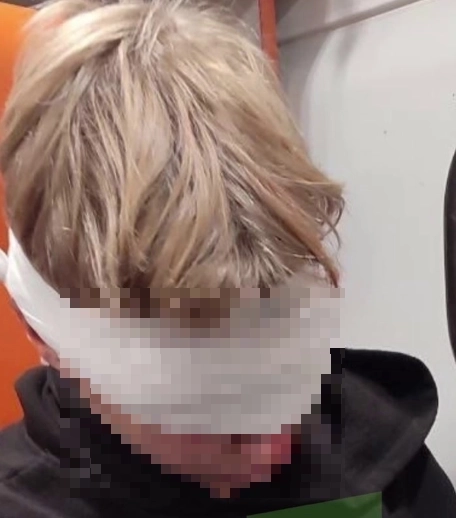 Врачи не дают гарантий, что зрение сохранится.