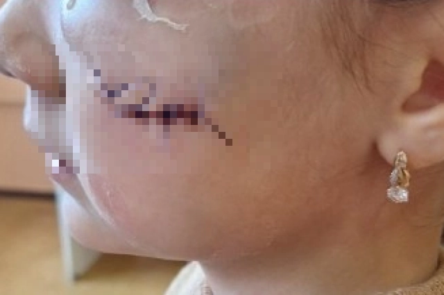 После травмы девочка боится игровых комнат