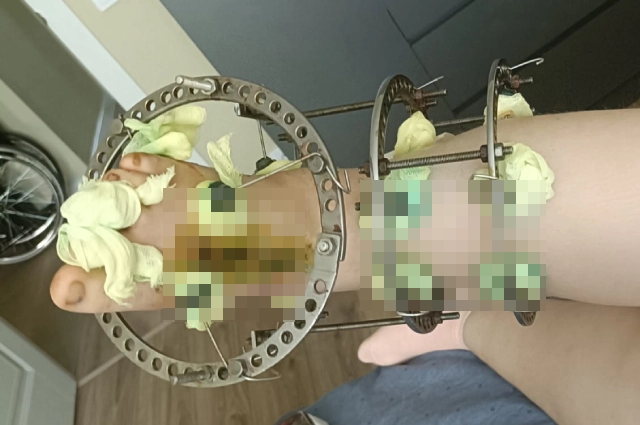 Кира пережила уже 4 операции.