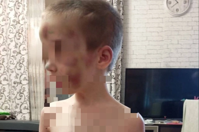 Избитая 6-летняя девочка