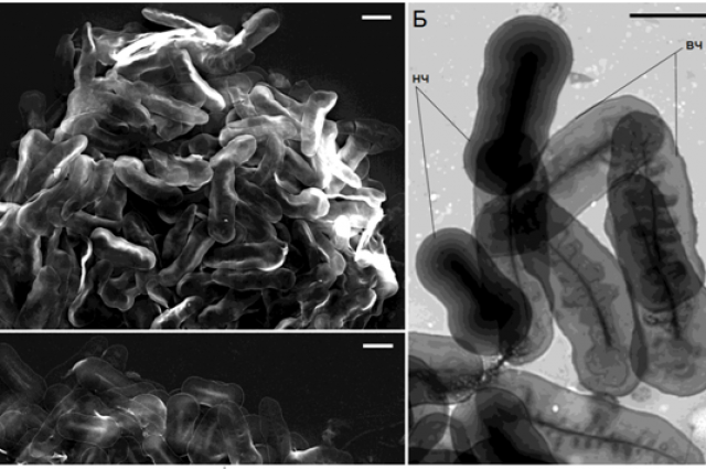 Наружные чешуйки, покрывающие клетку простейших нового рода и вида Pinjata ruminata gen. et sp. n. (А-В) электронная микроскопия чешуек.