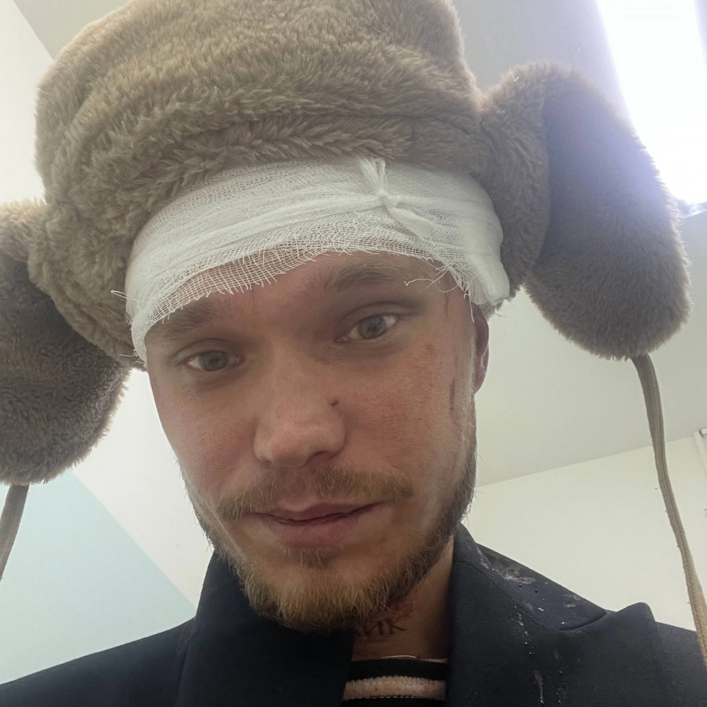 Сейчас блогер чувствует себя лучше, его здоровью ничего не угрожает.