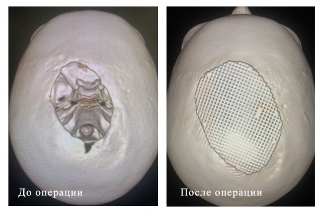 Илье предстояло пройти несколько операций и реабилитацию.