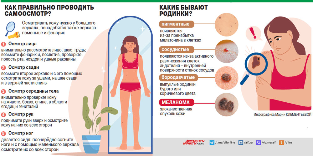 Родинки на теле и их значение у женщин с медицинской точки зрения фото