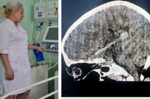 Каким-то чудом шампур не задел сам глаз, зрение сохранено