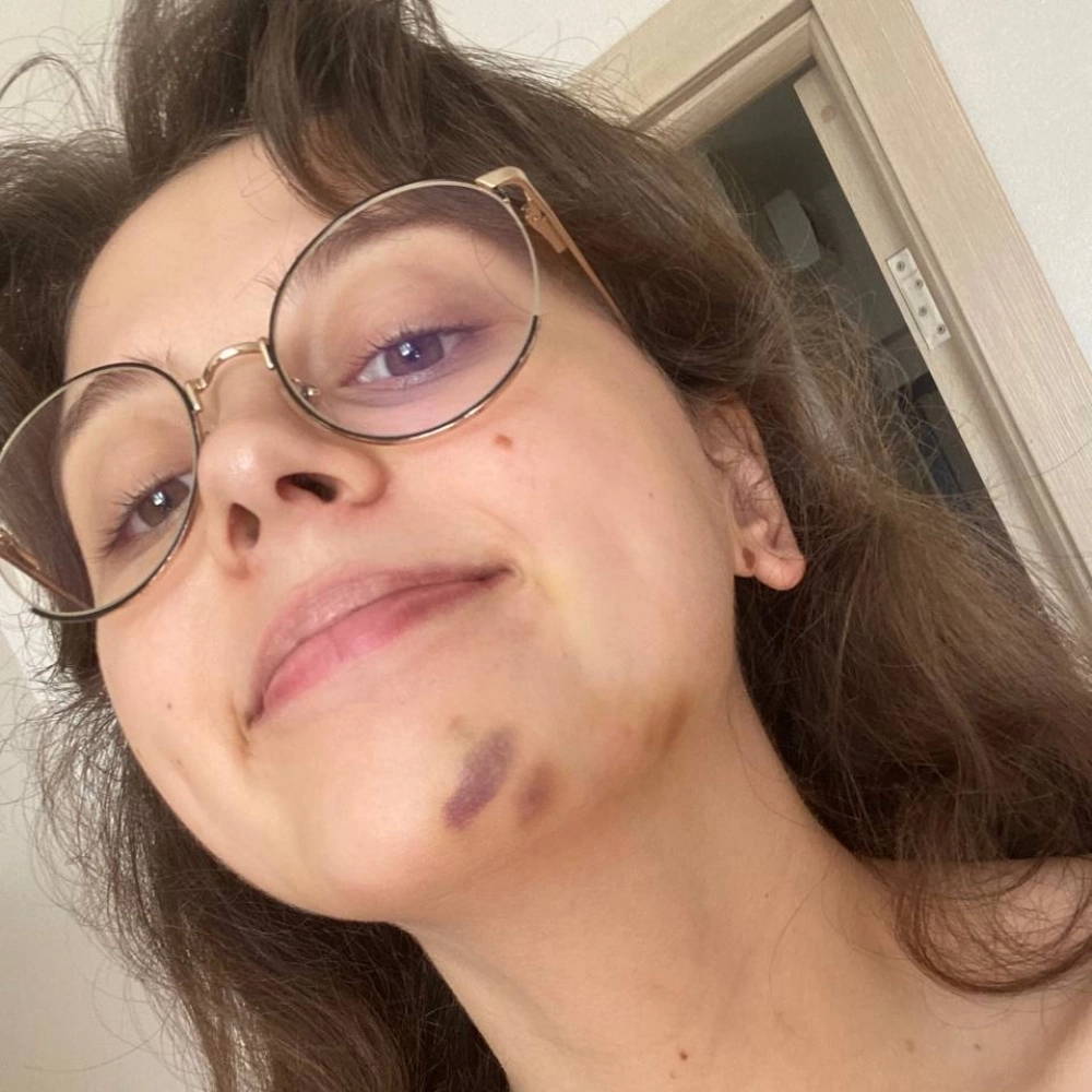 Алексей начал избивать девушку спустя месяц после знакомства.