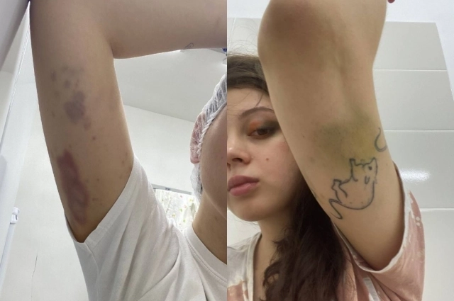 Лера снимала побои, обращалась в полицию, но все безрезультатно.