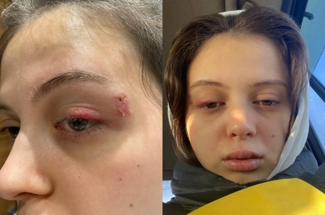 Девушку избивали и насиловали больше года.