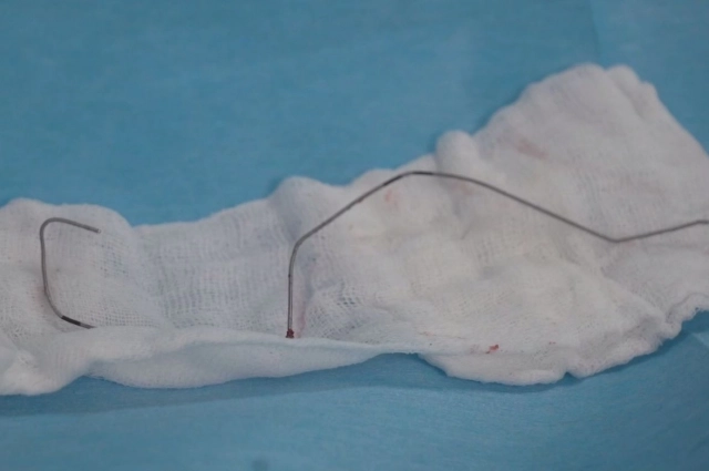 Эта струна была в груди подростка