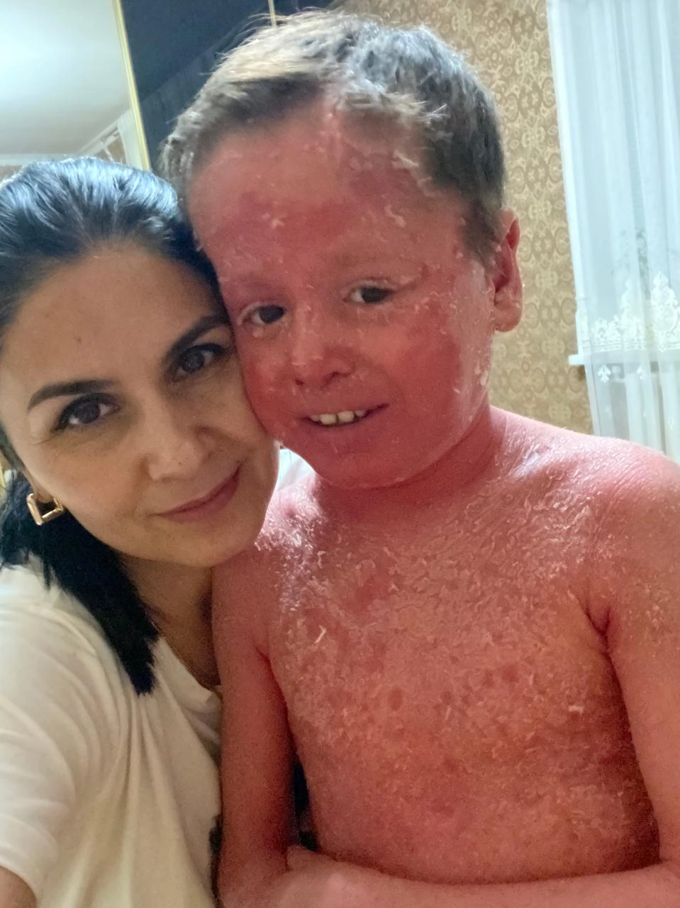 Малыш мечтает стать похожим на других детей.