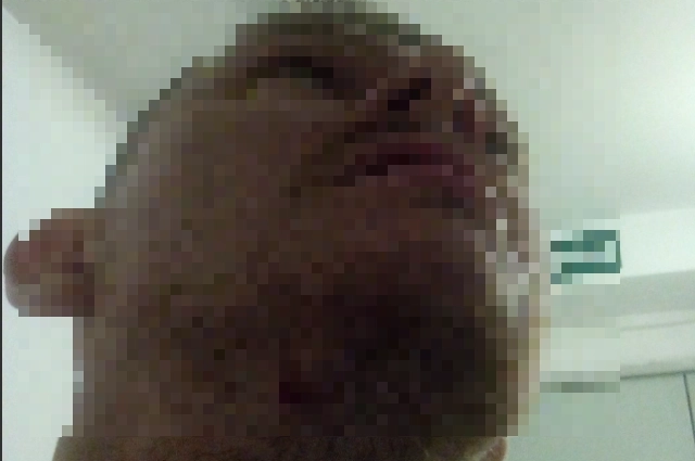 Челябинец показал место удара. 