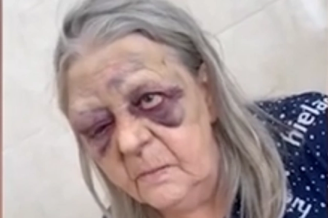 В таком виде бабушку увидели родственники, навестив её в больнице.