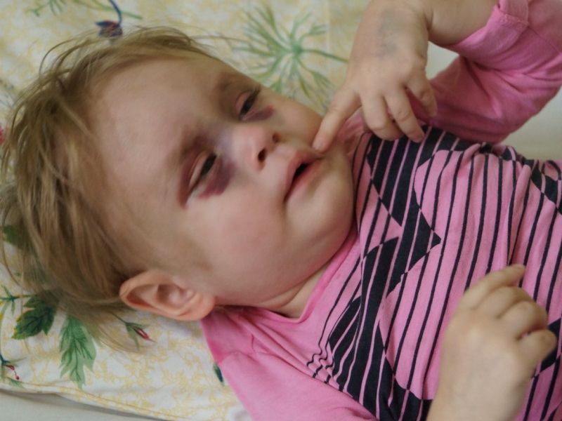 Жительница Актау подняла тревогу, увидев фото избитого ребенка