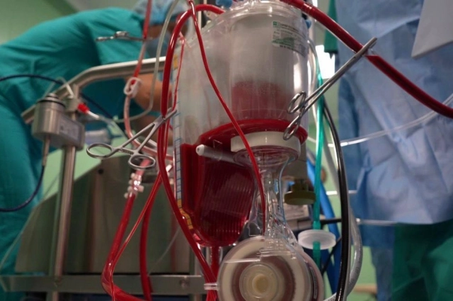 Сложнейшие операции на сердце проводят иркутские врачи.