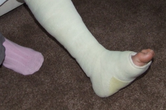 В последнее время Юрий Антонов перенес несколько операций, в том числе на ногу.