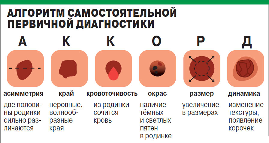 Меланома: описание заболевания