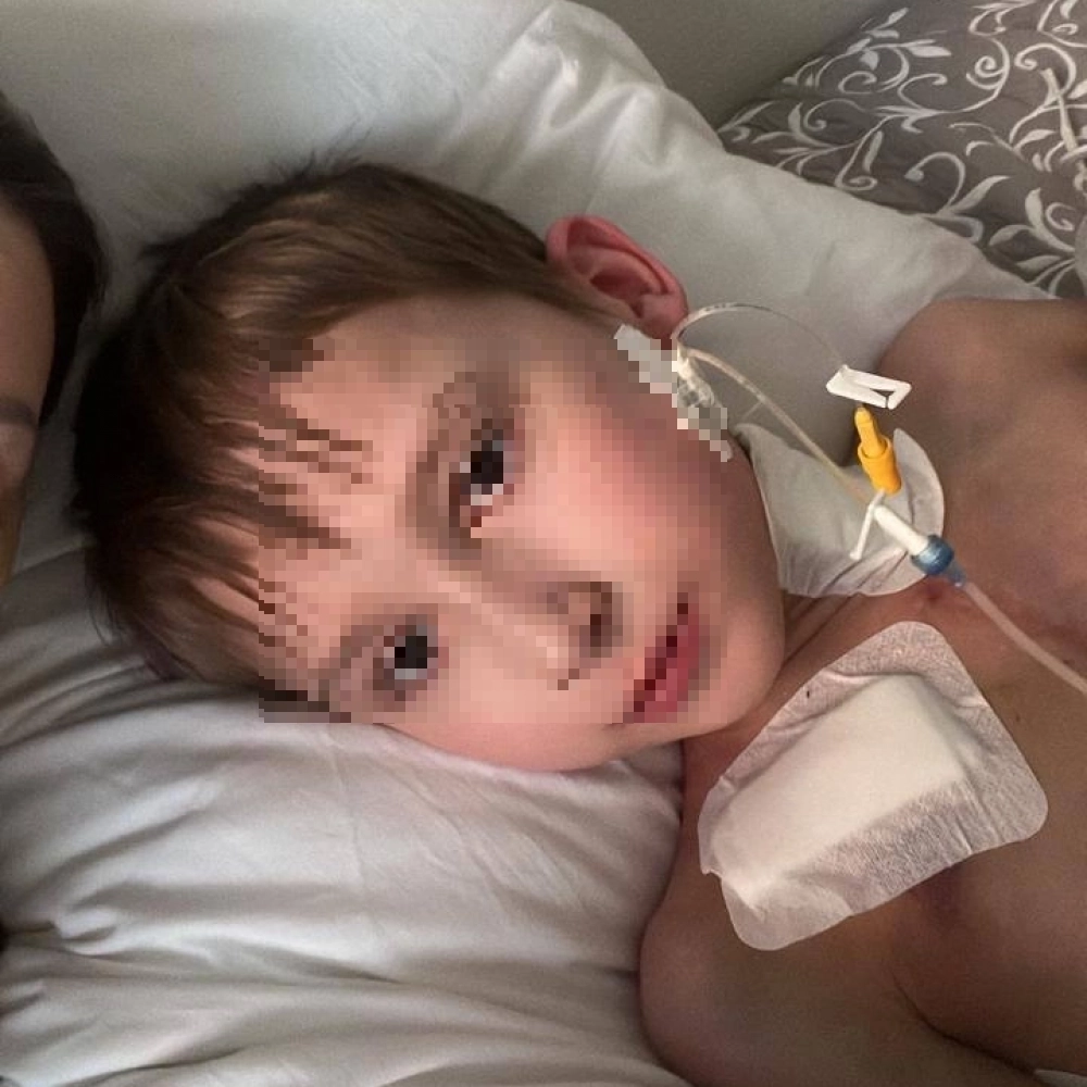 Недавно у мальчика снова начала набираться жидкость в легких.