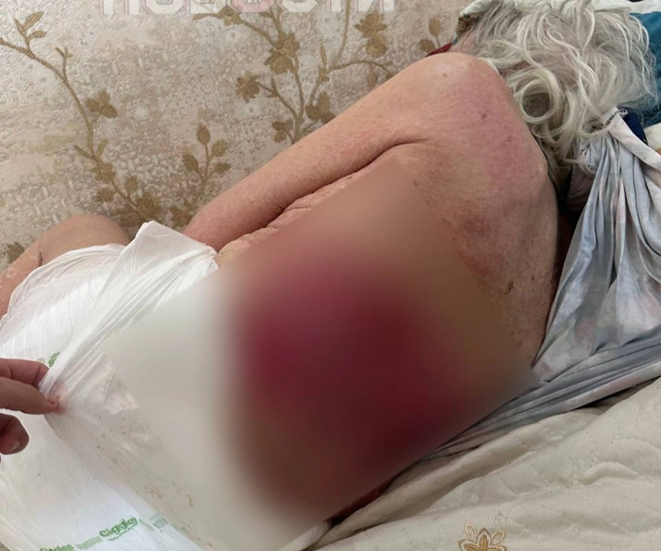 Сиделка избивала пенсионерку