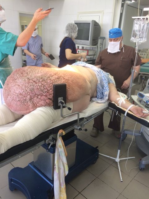 Анестезиолог-реаниматолог Александр Зайцев стоит у изголовья операционного стола.