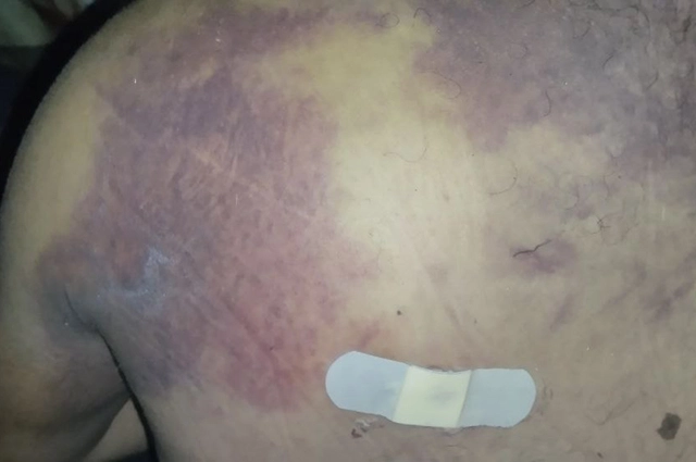 Ранение Богдана.