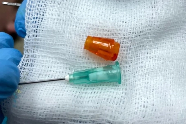 Ранее у двух маленьких пациентов в бронхах обнаружили деталь от конструктора и колпачок ручки.