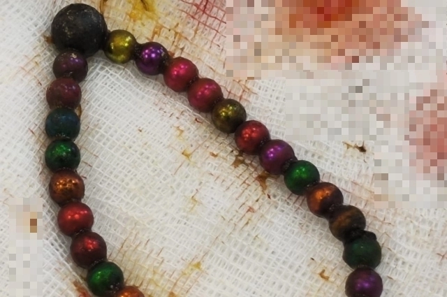 30 ярких шариков едва не унесли жизнь малыша. 