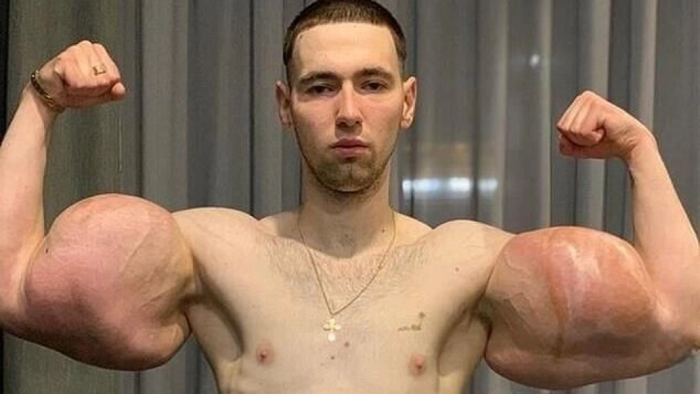 Цена славы без мозгов. Кирилл «Руки-базуки» потерял свои «мышцы мечты»
Цена славы без мозгов. Кирилл «Руки-базуки» потерял свои «мышцы мечты»