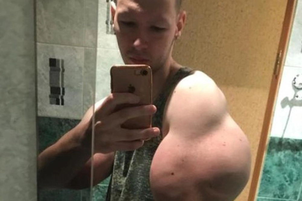 Цена славы без мозгов. Кирилл «Руки-базуки» потерял свои «мышцы мечты»
Цена славы без мозгов. Кирилл «Руки-базуки» потерял свои «мышцы мечты»