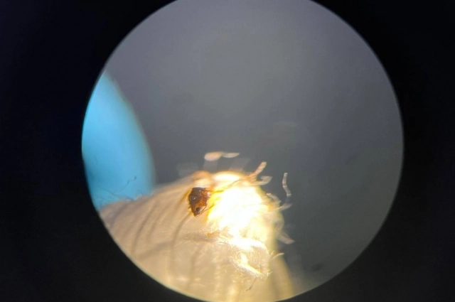 Таракана достали из глаза