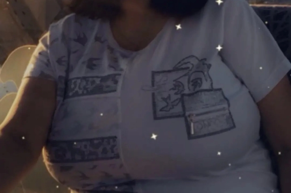 Грудь росла в течение десяти лет.