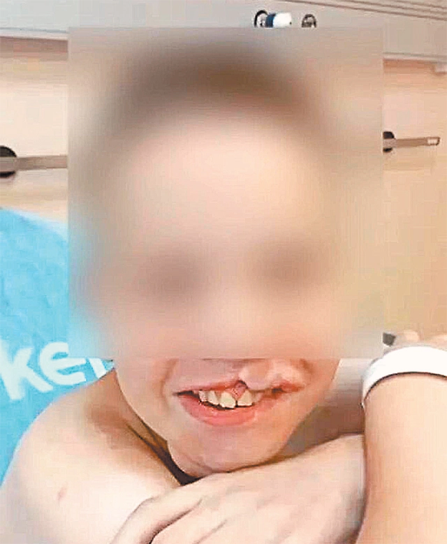 Десятки людей захотели усыновить мальчика из&nbsp;Кузбасса. Но&nbsp;пока ему лечат раны телесные, о&nbsp;приёмной семье говорить рано.