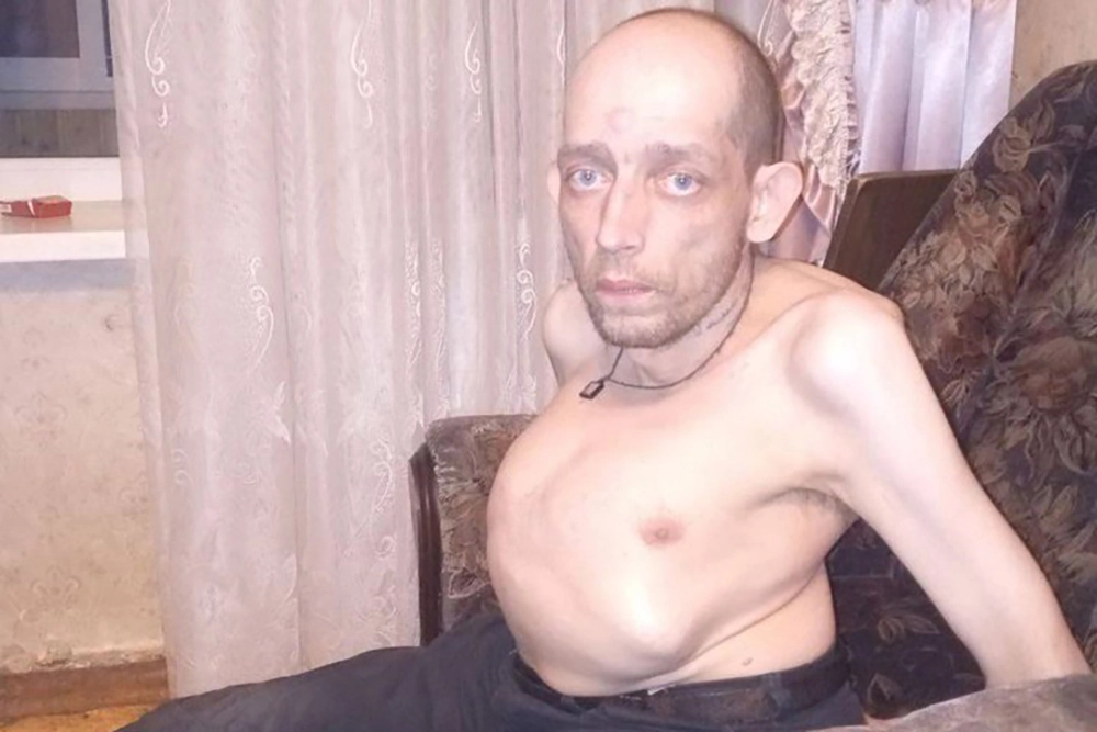 Проблемы Куликова начались еще с самого рождения, его признали инвалидом I группы в детстве, когда врачи диагностировали тяжелый полинейропатический синдром.