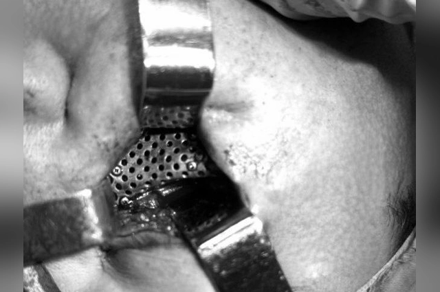 Лицо женщины было сильно повреждено.