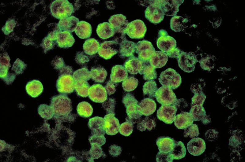 Амеба Naegleria fowleri.