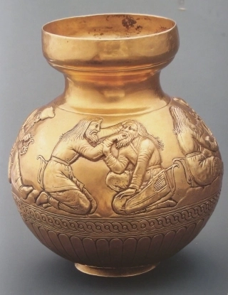 Сцена лечения зуба на вазе из кургана Куль-Оба.