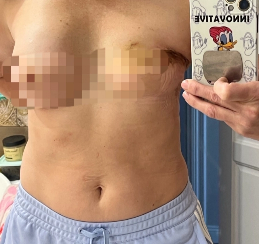 Светлане предстоит пережить ещё две сложные и дорогостоящие операции.