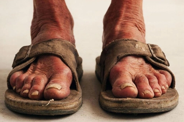 Старые тапочки опасны во всех отношениях