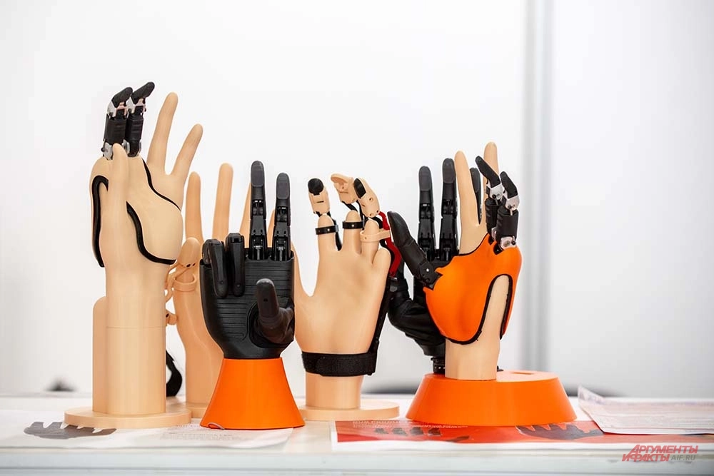 Протезы кистей и фаланг пальцев.