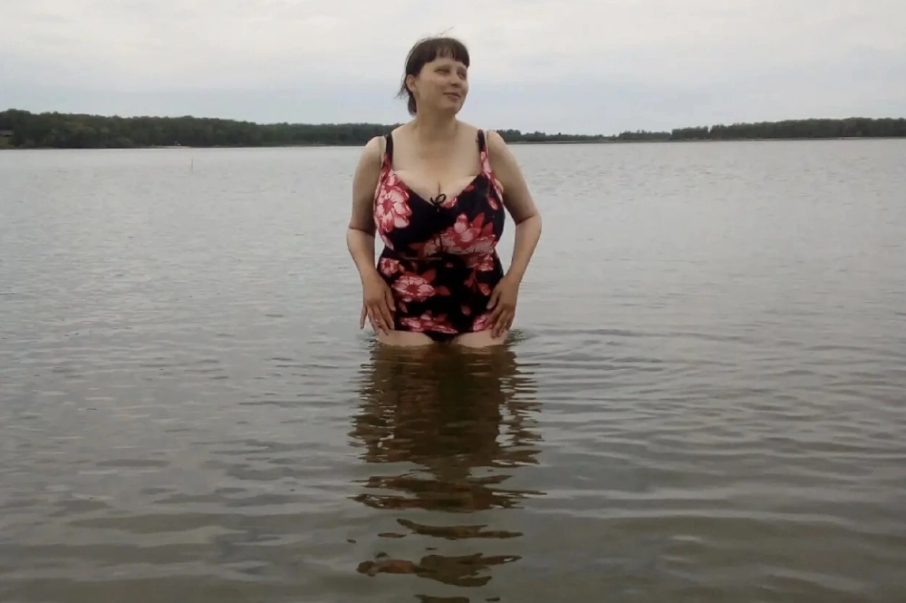 Екатерина до операции.