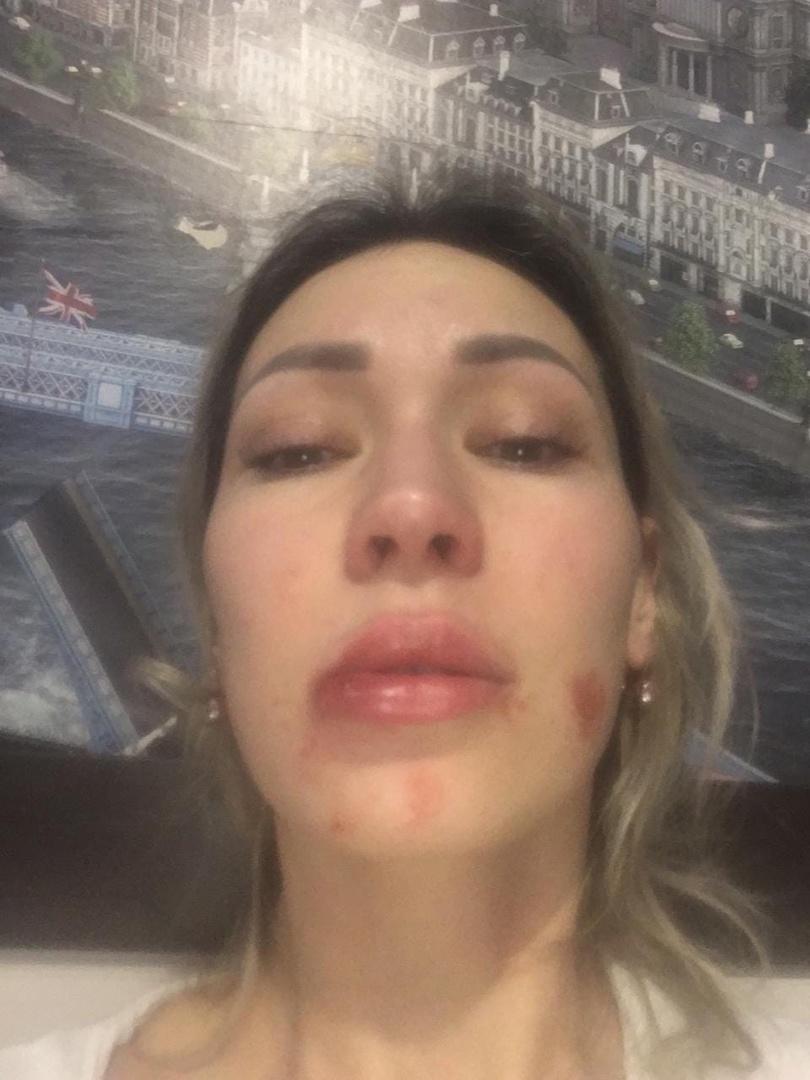 Дина Махиянова после очередного избиения