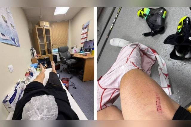 Бараков получил ушиб и не смог продолжить соревнование.