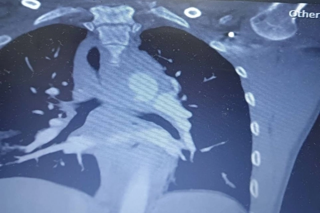 У мужчины многочисленные травмы после ДТП.