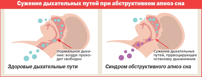 Нажмите для увеличения