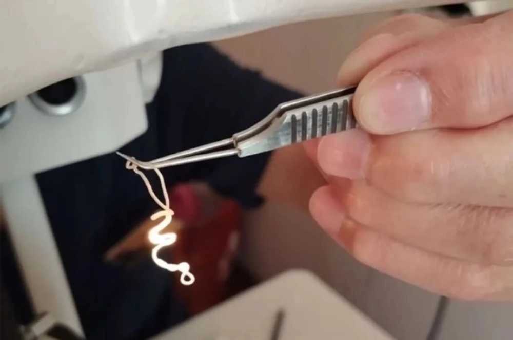 Вот такого «монстра» вытащили из глаза мужчины в Чувашии.