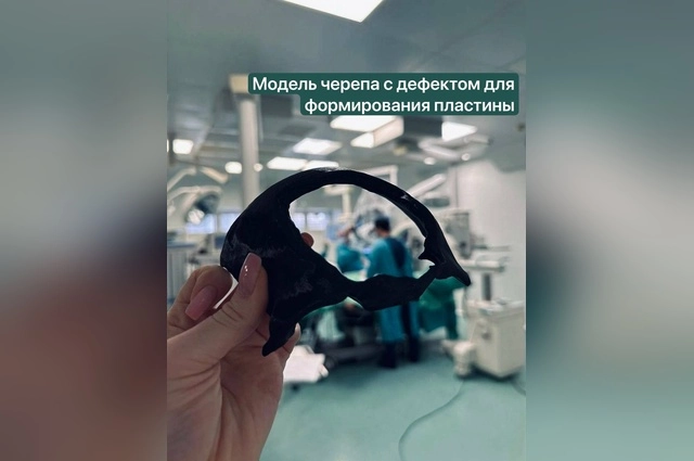 Часть черепа врачи смогли восстановить на 3д-принтере.